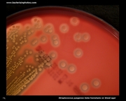 beta hemolysis on blood agar